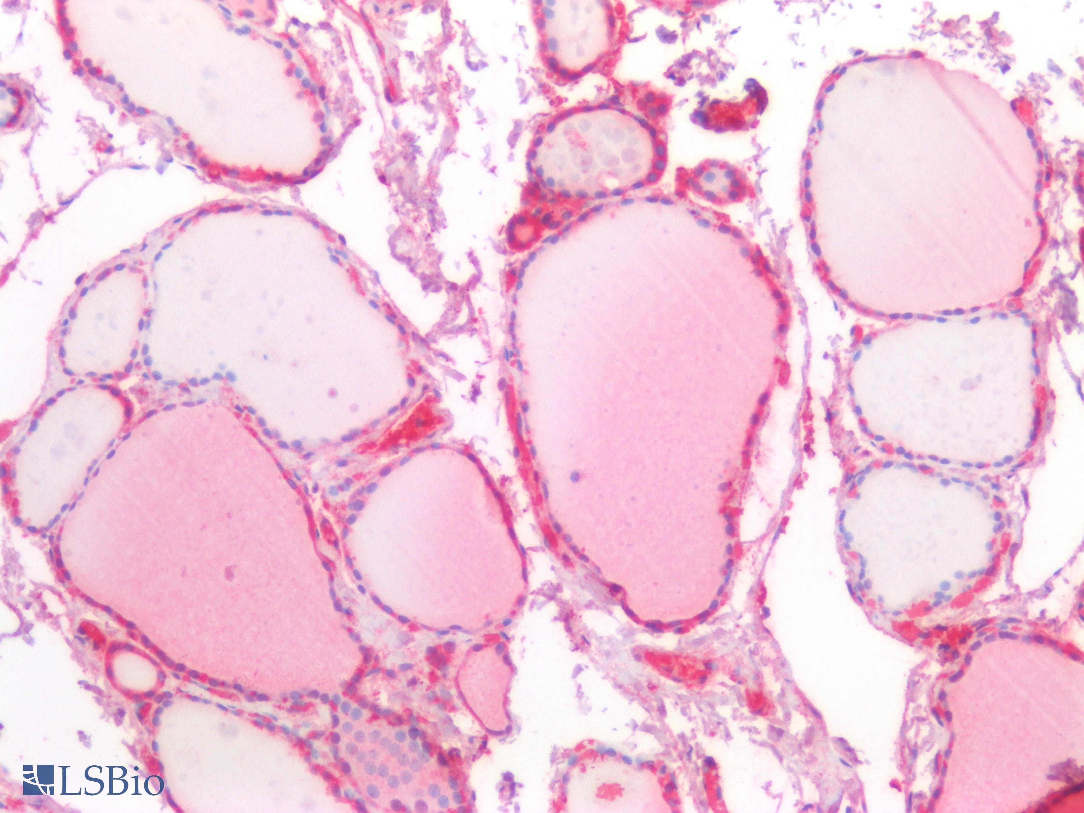 PathPlus™ VPS37A Antibody