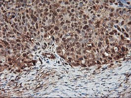 PSMA4 Antibody (clone OTI5D8)