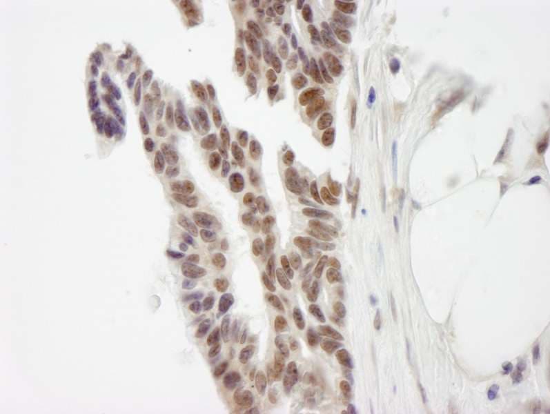 Polyclonal Rabbit anti-Human ZMYM3 Antibody (aa250-300, IHC)