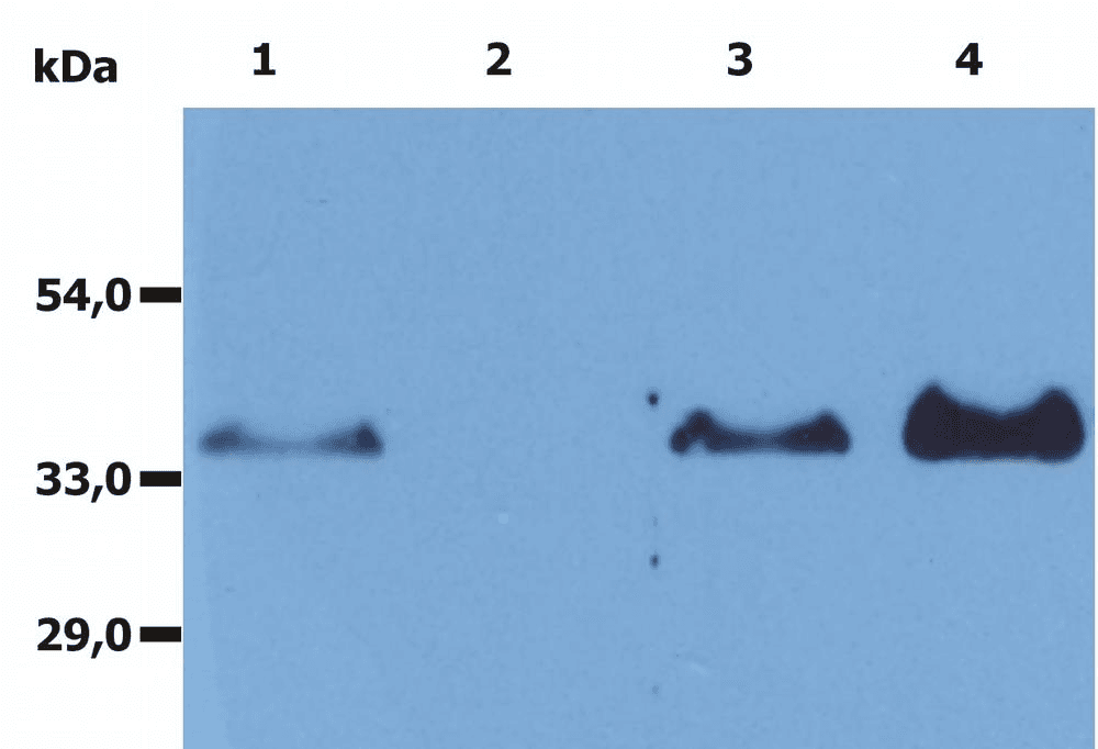 Monoclonal Mouse anti-Human CD20 Antibody (clone MEM-97, Azide-free)