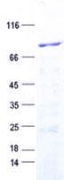 Human MCCC1 Protein (Recombinant His, N-Terminal)
