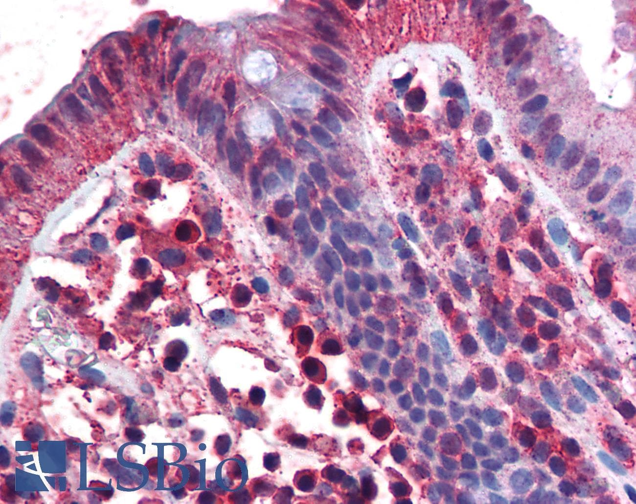TNFRSF17 / BCMA Antibody
