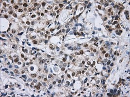 Monoclonal Mouse anti-Human DCXR Antibody (clone OTI7D11, IHC, WB)
