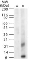 WNV GpM Antibody (aa8-27)