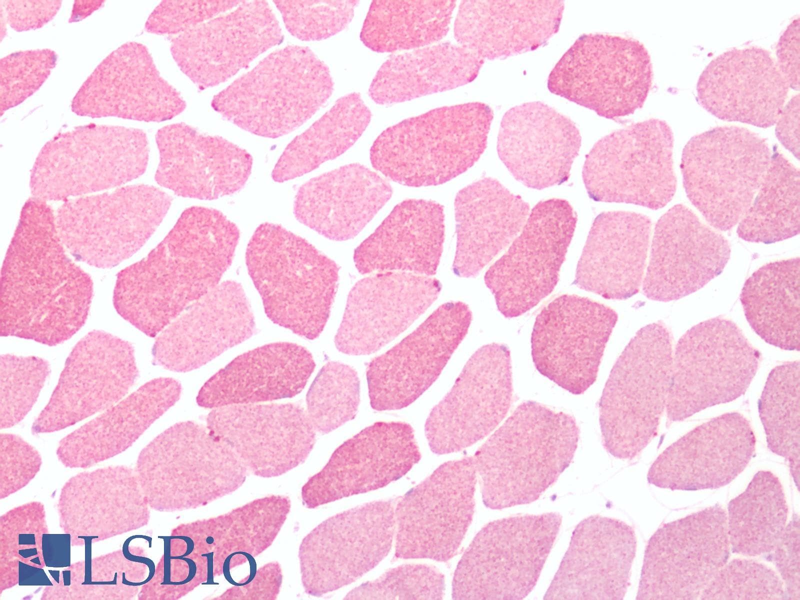 IHC-plus™ Polyclonal Rabbit anti-Human VMD2L3 / BEST3 Antibody (Cytoplasmic Domain, IHC)