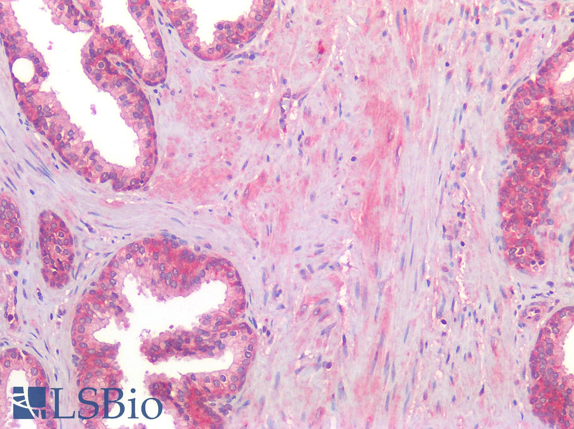 IHC-plus™ AGTR2 / AT2 Receptor Antibody (Internal)