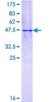 Human NTS / NT / Neurotensin Protein (Recombinant GST)
