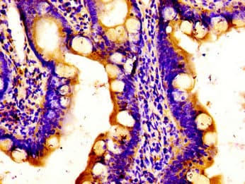 Polyclonal Rabbit anti-Human APOBEC3D Antibody (IHC)