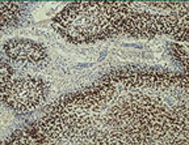Monoclonal Mouse anti-Human ARNT / HIF-1-Beta Antibody (clone H1beta234, DY550, aa496-789, IHC, WB)