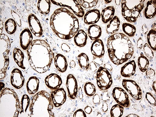Monoclonal Mouse anti-Human MCAD / ACADM Antibody (clone OTI9G10, IHC, WB)