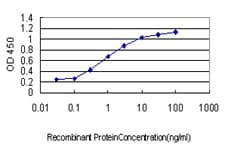 Monoclonal Mouse anti-Human DYRK / DYRK1A Antibody (clone 7D10, WB)