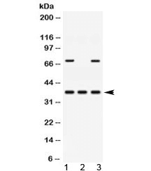 AKR1B1 / Aldose Reductase Antibody
