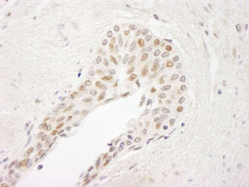 ATRIP Antibody (aa100-150)