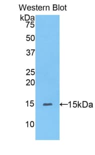 PPARD / PPAR Delta Antibody (aa29-147)