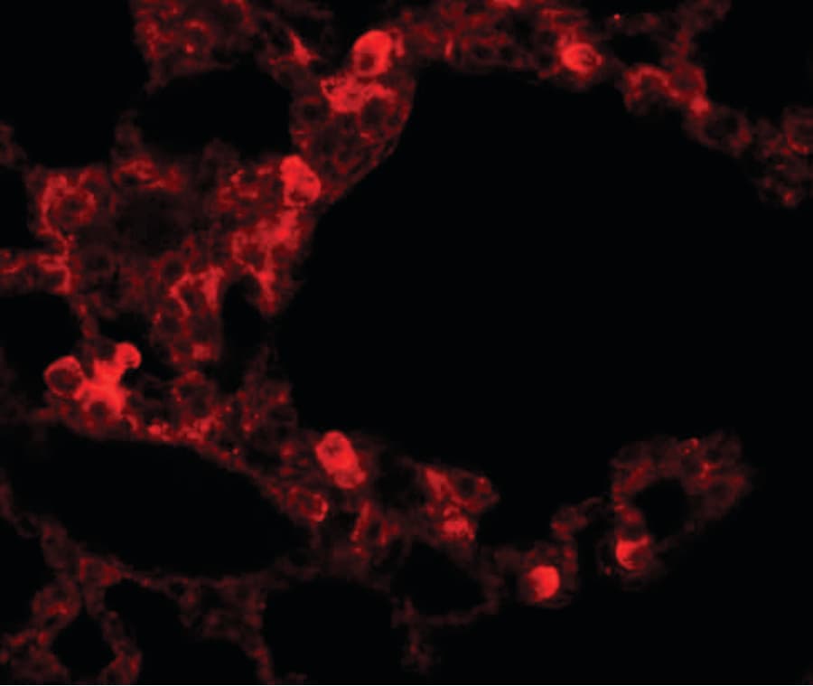 ESRP2 / RBM35B Antibody