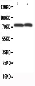 Polyclonal Rabbit anti-Human ABCG4 Antibody (aa327-341, WB)
