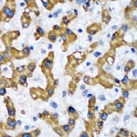 VAPB Antibody
