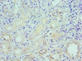 LRP6 Antibody (aa20-150)