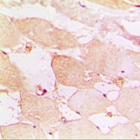 CXCR3 Antibody (Internal)