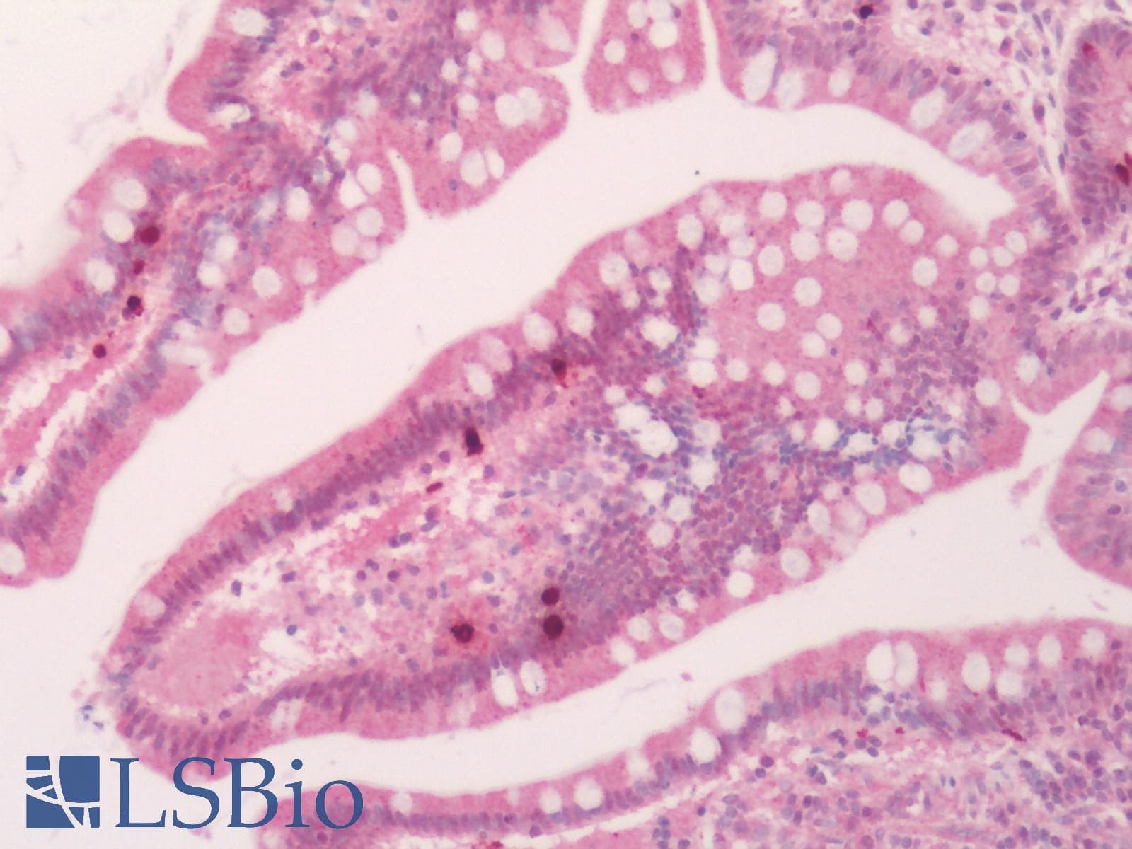 PathPlus™ HTR4 / 5-HT4 Receptor Antibody (Cytoplasmic Domain)