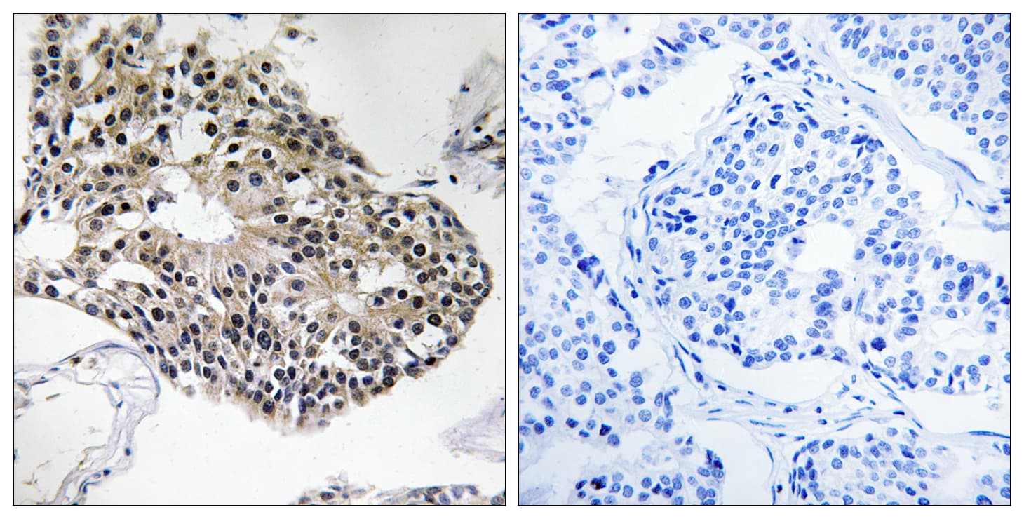 RPS25 / Ribosomal Protein S25 Antibody (aa76-125)