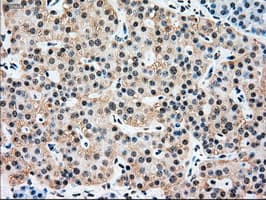 Monoclonal Mouse anti-Human SSB / La Antibody (clone OTI6G7, IHC, IF, WB)