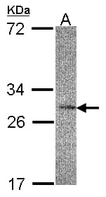 IL-22BP / IL22RA2 Antibody (aa1-218)