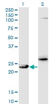 GSTZ1 Antibody (clone 1G12)