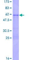 Human SNAI1 / SNAIL-1 Protein (Recombinant GST)