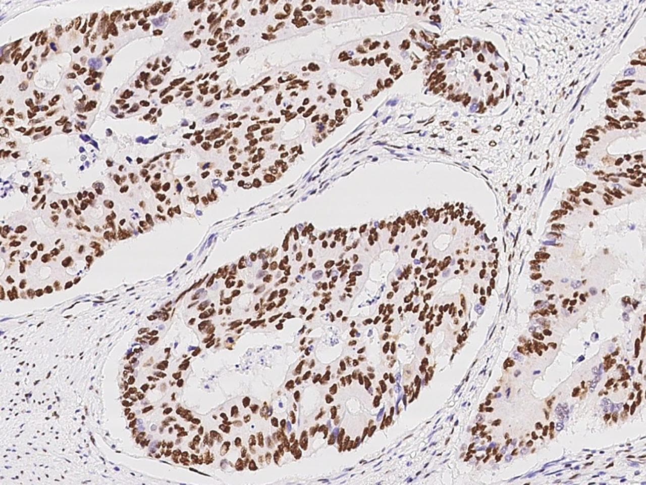 HNF1B / HNF1 Beta Antibody