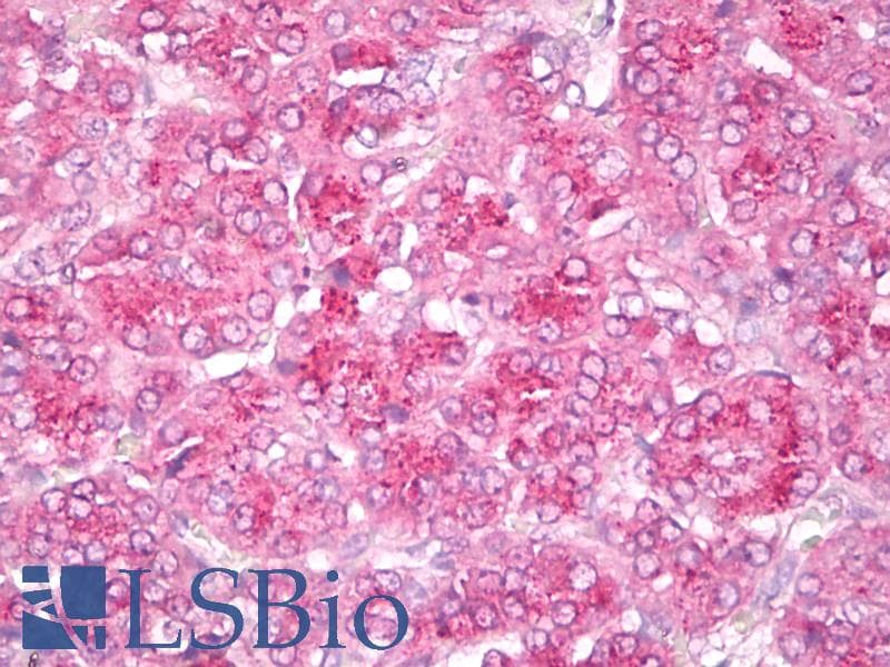 IHC-plus™ GIT2 Antibody (clone 3B5-B9)