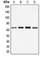 FOXO4 / AFX1 Antibody (Internal)