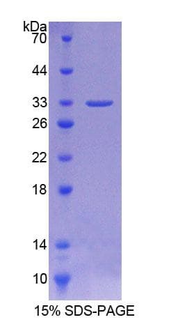Rat AURKC / Aurora C Protein (Recombinant His-T7)