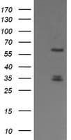 PLK1 / PLK-1 Antibody (clone OTI9E9)