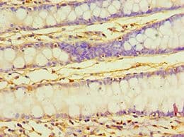 PDHX / Protein X / ProX Antibody (aa1-300)