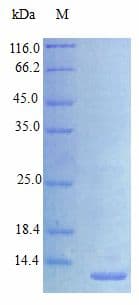 Human HBEGF / HB EGF Protein (Recombinant)