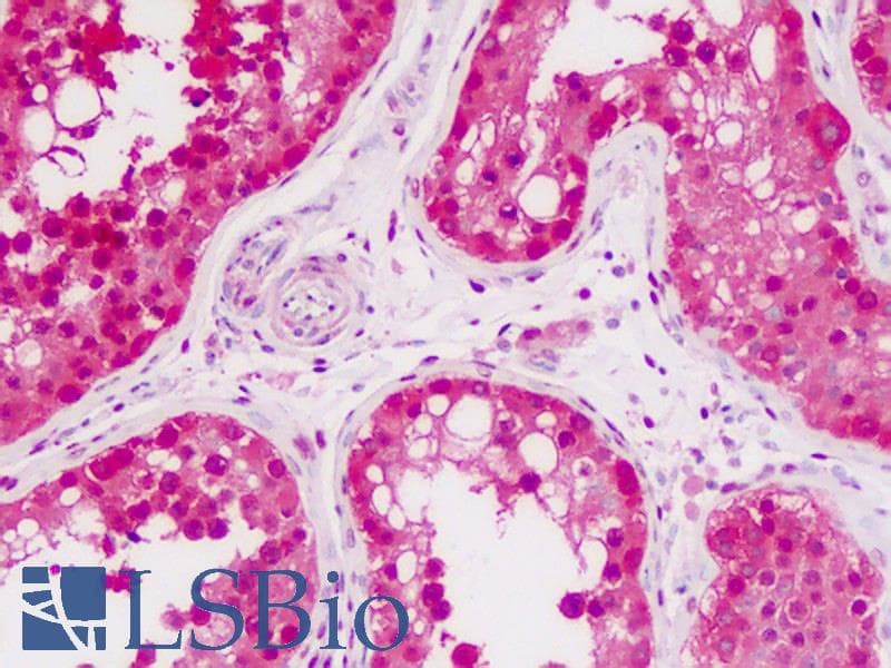 IHC-plus™ Heat Shock Protein 70 / HSPA1A Antibody (Tyr525)