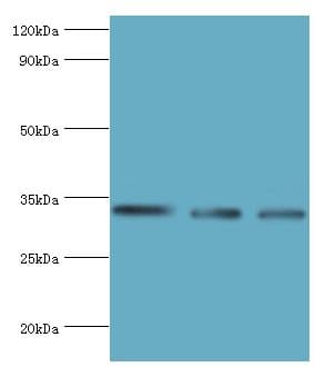 HSD11B1 / HSD11B Antibody (aa25-292)