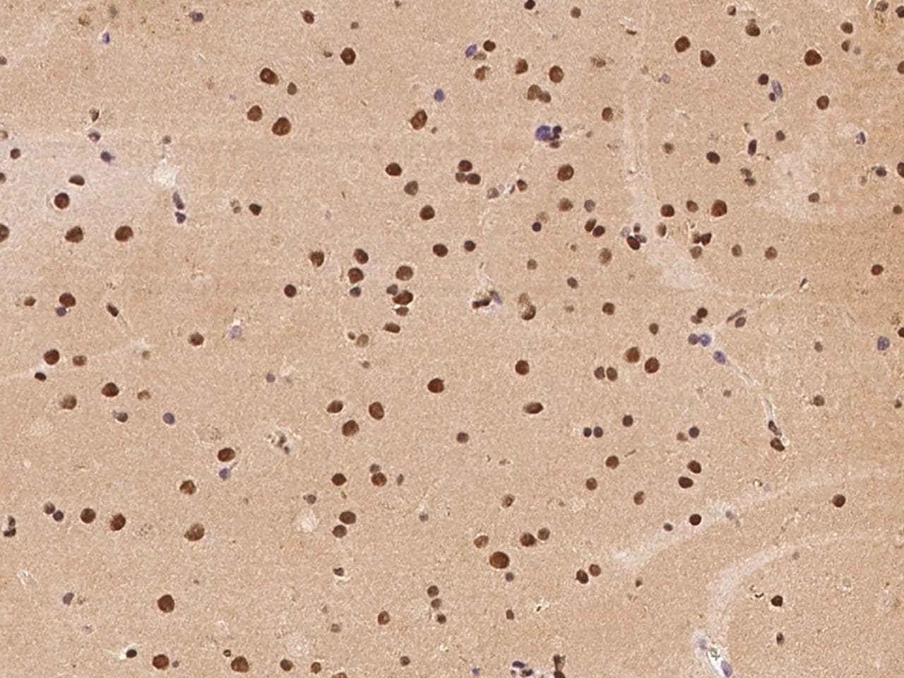 ATXN7L2 Antibody