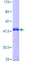 Human CETN1 Protein (Recombinant GST)