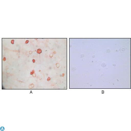 HHV-8 K8 alpha Antibody