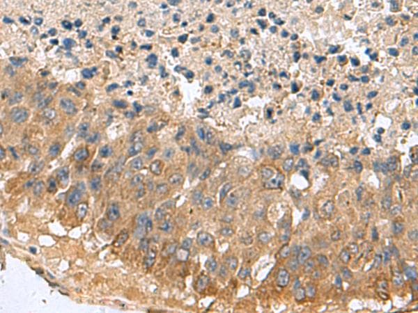 MARCKSL1 Antibody