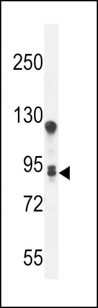 Polyclonal Rabbit anti-Human TMEM168 Antibody (aa558-587, WB)