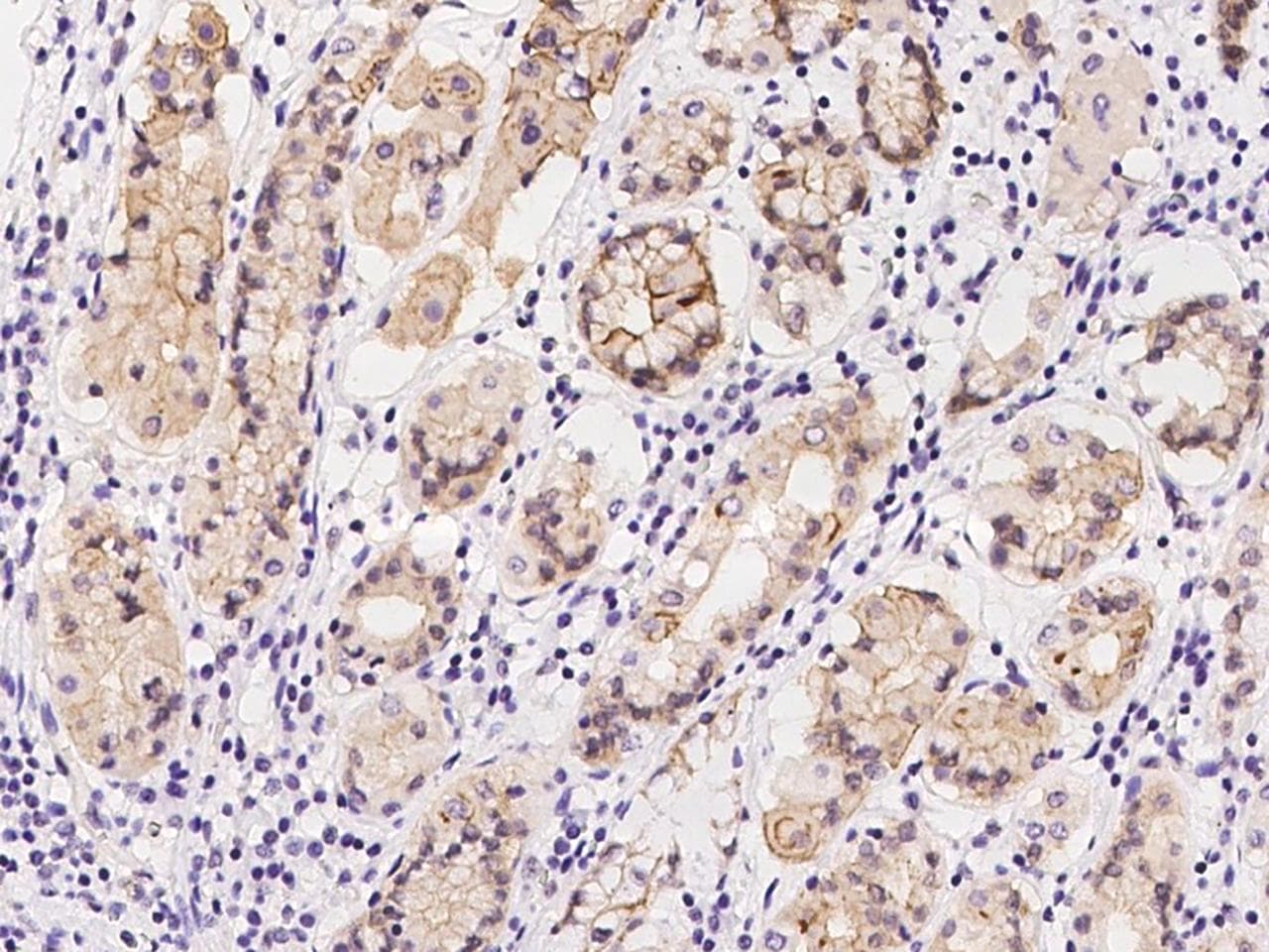 CTTN / Cortactin Antibody