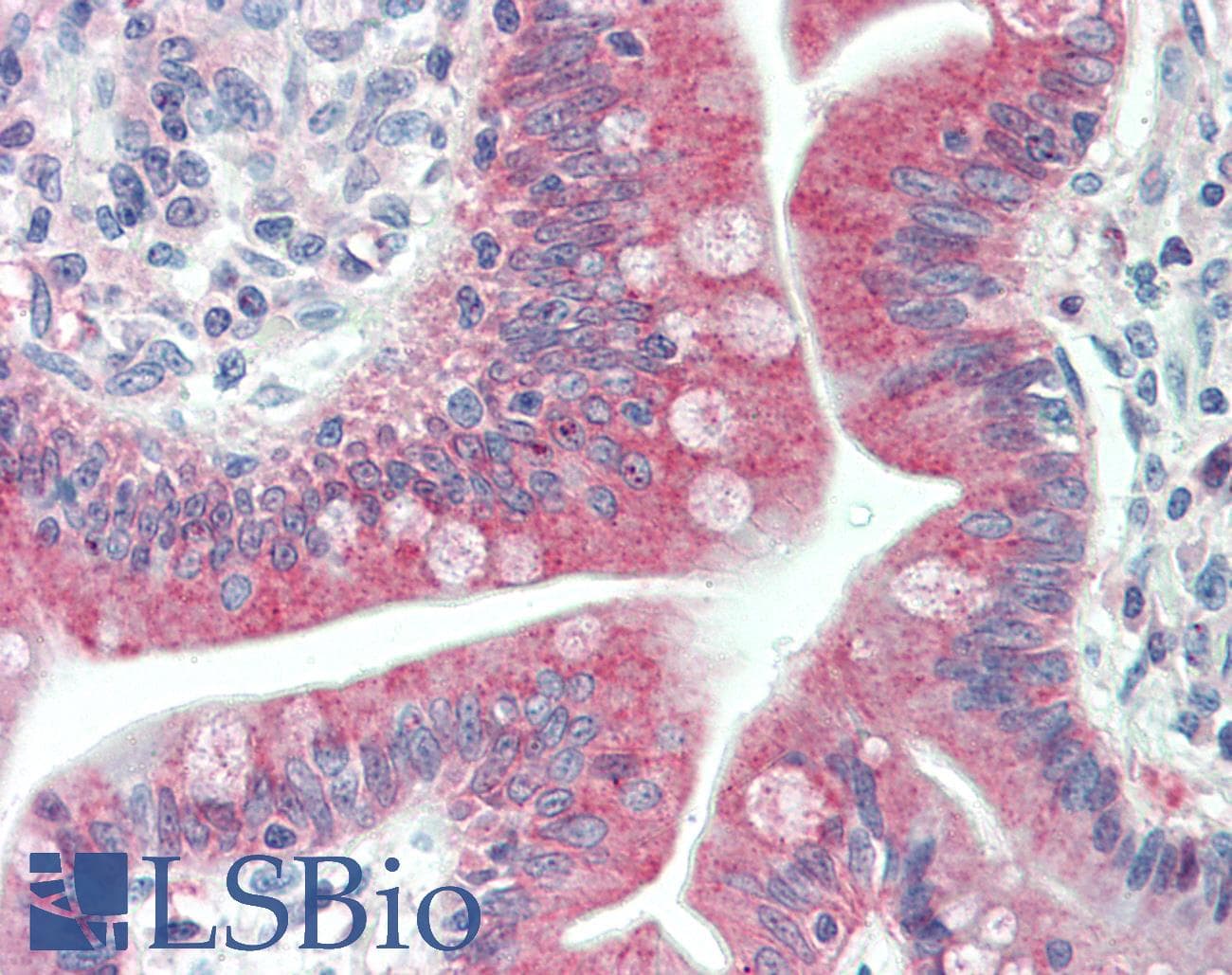 IHC-plus™ MAP1LC3C / LC3C Antibody (Thr48)