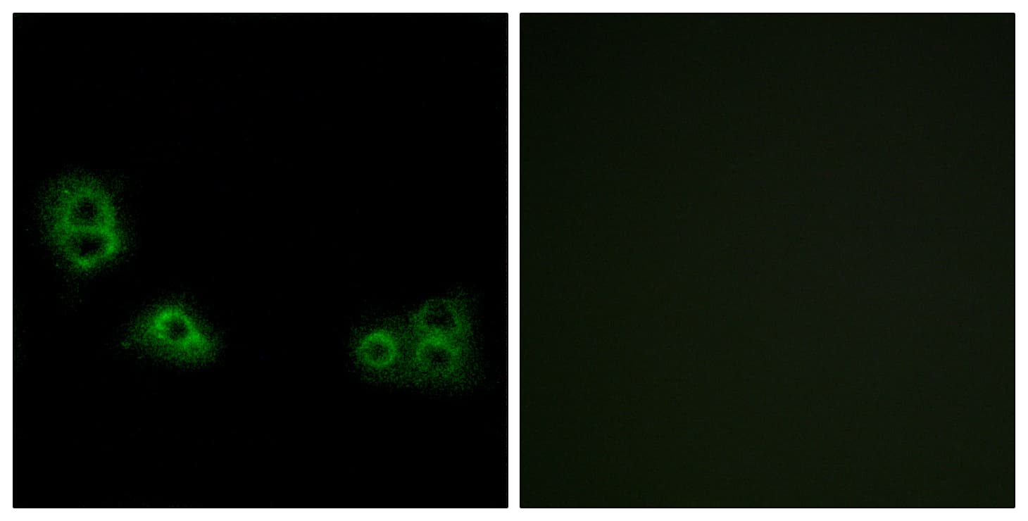TMEM185A / FAM11A Antibody (aa290-339)