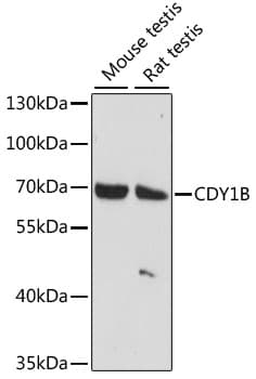 Polyclonal Rabbit anti-Human CDY1 Antibody (WB)