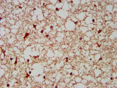 Polyclonal Rabbit anti-Human BCKDHA / BCKDE1A Antibody (IHC, WB)