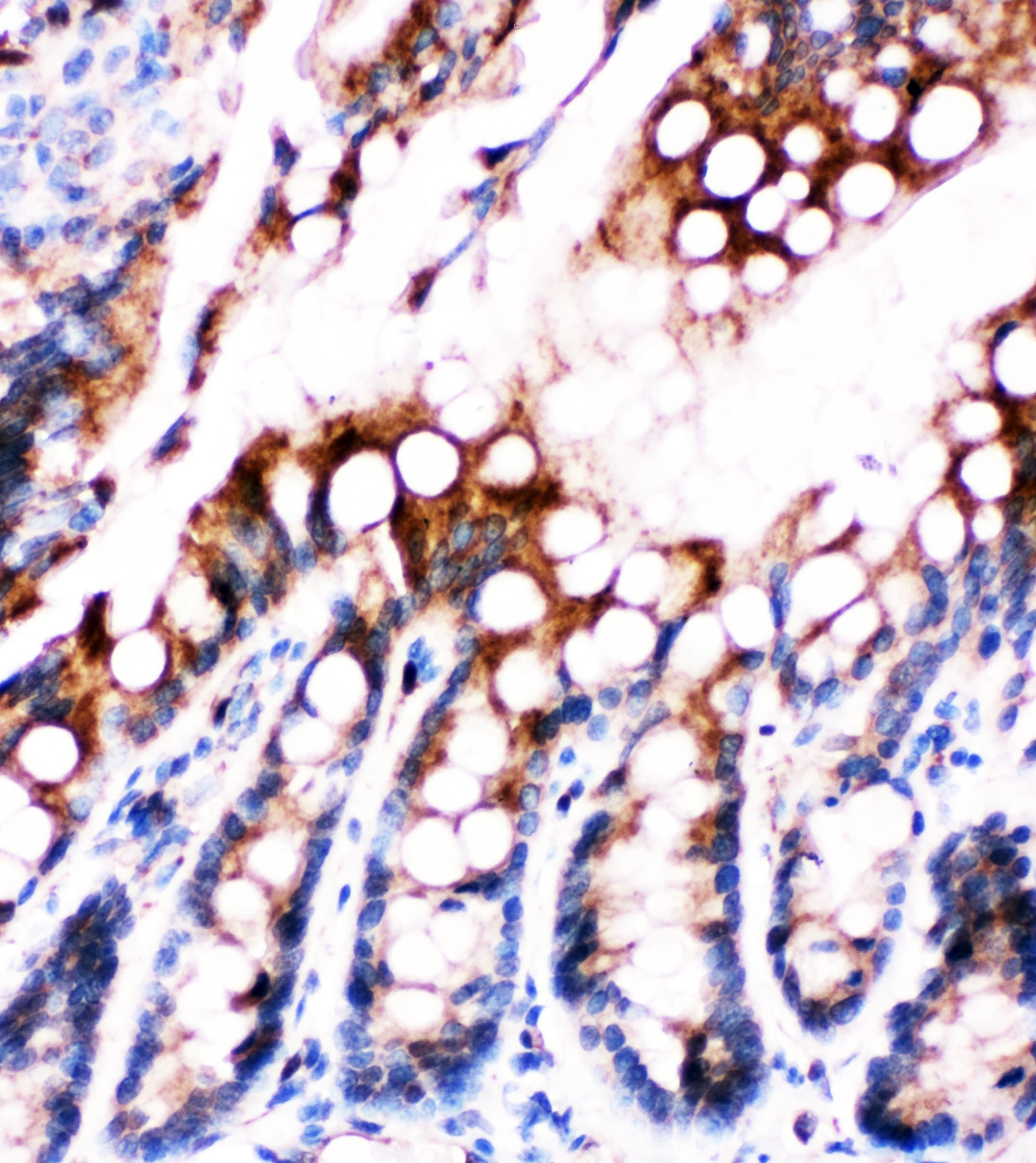 E-FABP / FABP5 Antibody (aa10-23)