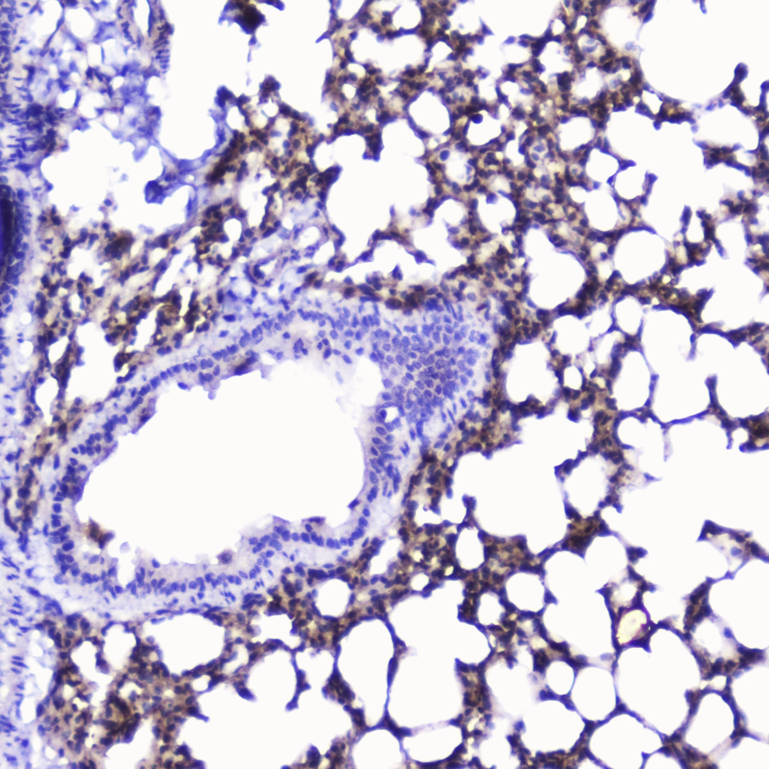 TLN1 / Talin 1 Antibody